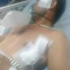 Hampir Tiga Tahun Menanti Keadilan, Korban Penganiayaan di Sibolangit Ajukan Perlindungan ke LPSK: Soroti Lambannya Penanganan dan Sulitnya Akses Informasi