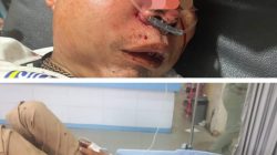 Korban Kecelakaan di Koto Baru Singingi Hilir Belum Teridentifikasi, Diduga Pengendara dari Medan Menuju Teluk Kuantan
