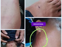 Belum Ada SP2HP Laporan Sekagesima, Narasi Pembacokan Belum Dikoreksi: ATHIA Siapkan Dua Langkah Hukum